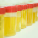 jars of urine